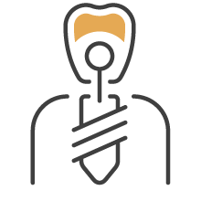 入れ歯・インプラント